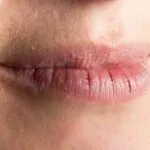 trockene Lippen tipps honig lippenpflege