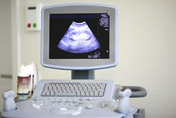 © Peter Atkins - Fotolia.com Untersuchungen in der Schwangerschaft - Per Ultraschallgerät vieles erfahren